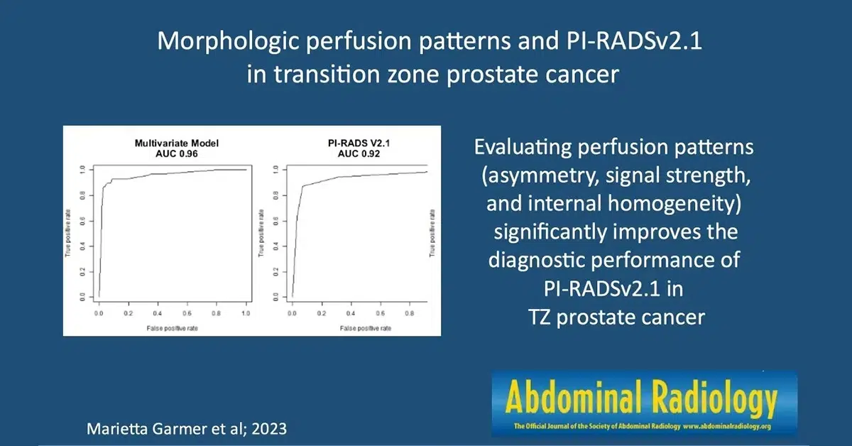 kontrastmittel multiparametrisches MRT Prostata Grafik kontrastmittel multiparametrisches MRT Prostata